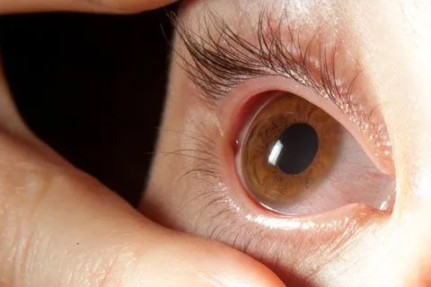 Eye close up held open